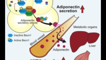 تأثير البروتين على حساسية الأنسولين: نهج شمولي